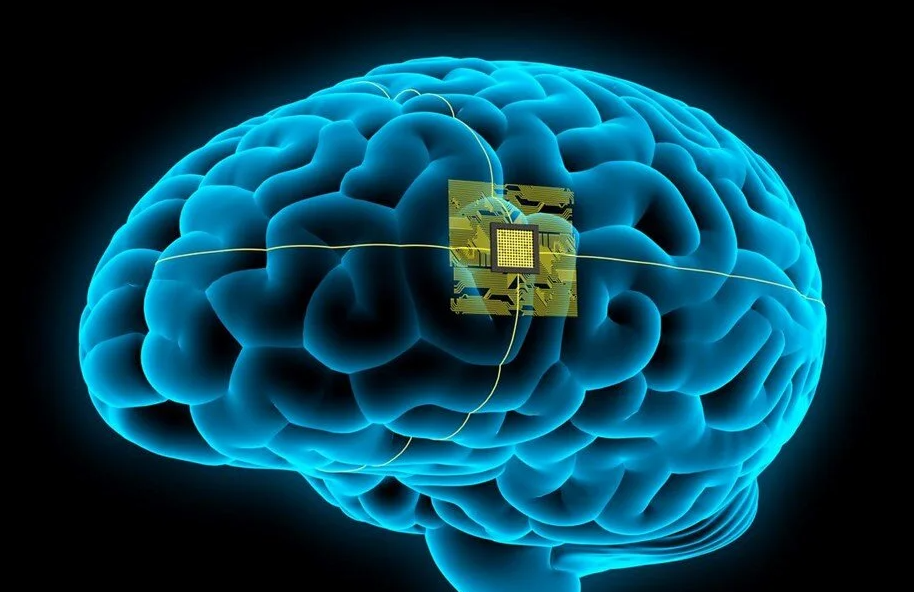 Beyin İmplantlarıyla Zihin Okuma
